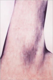Pink man III